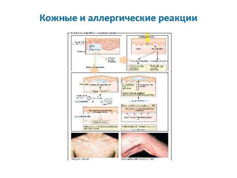 Аллергические реакции и кожные проблемы