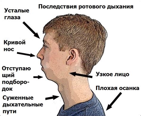 Аллергия и дыхание через рот у ребенка в возрасте год