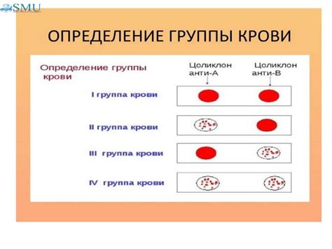 Альтернативные методы лечения в случае несовместимости резус-фактора