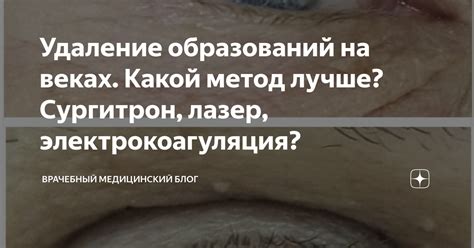 Альтернативные способы устранения нежелательных пигментных образований на веках