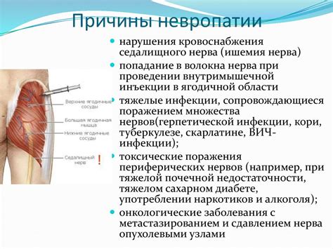 Анализ структуры и функций седалищного нерва