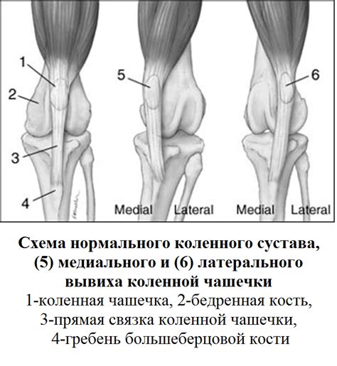 Анатомическое устройство коленной чашечки: основные компоненты