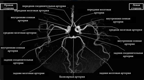 Анатомия Виллизиевой круга