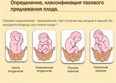 Анатомия и функциональность головного предлежания