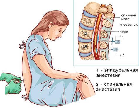 Анестезия и облегчение боли