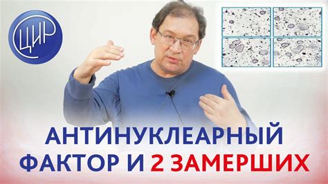 Антинуклеарный фактор 1 320: значение и роль в организме