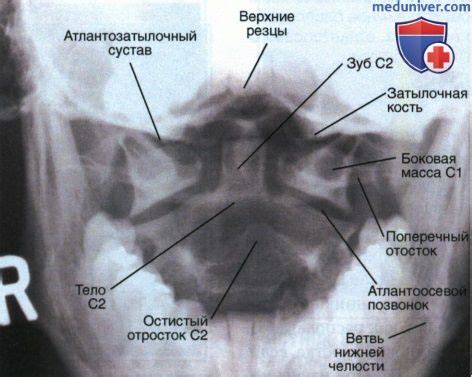 Важность второго позвонка в поддержании головы в вертикальном положении