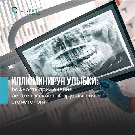 Важность применения механизма перехвата ночного сновидения в современном обществе