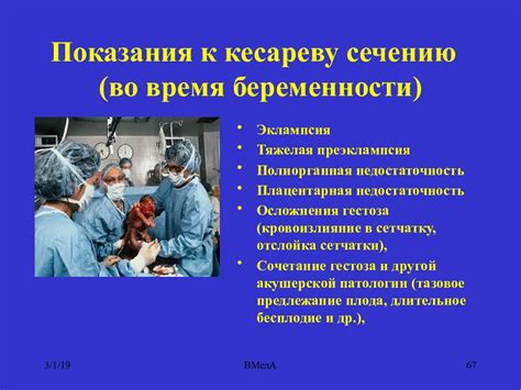 Важные советы по уходу за денимом для женщин, прошедших кесарево сечение