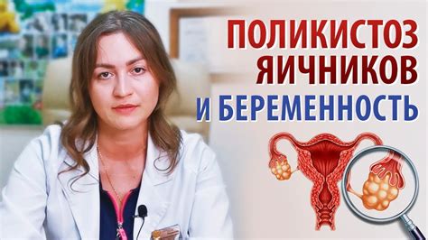 Важные факторы для успешной беременности при синдроме поликистозных яичников