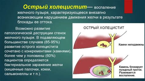 Виды новообразований в правом подреберье