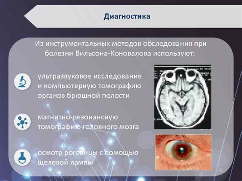 Вильсона-Коновалова диагностика: преимущества и недостатки