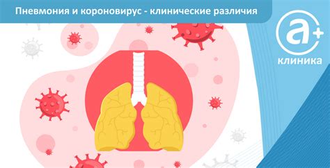 Вирусная полисегментарная пневмония при ковид