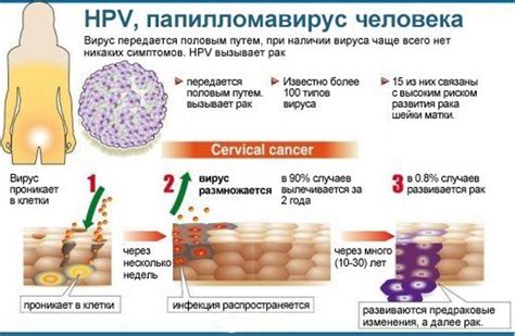 Вирус папилломы человека у детей: