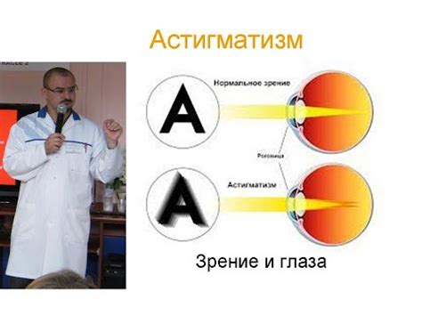 Вирус SARS: простыми словами о заболевании