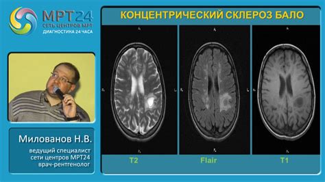 Влияние ароматических напитков на состояние при покалывании головного мозга