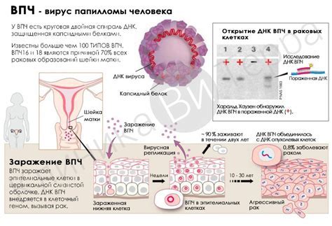 Влияние вируса папилломы человека на репродуктивное здоровье