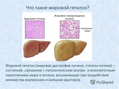 Влияние внешних факторов на возникновение жировой опухоли