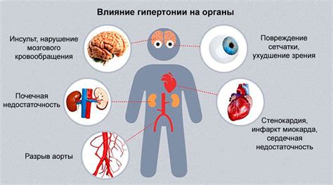 Влияние гипертонии и сосудистых проблем на зоны выше колена
