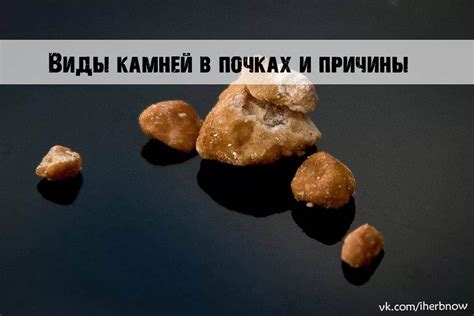 Влияние имбиря на процесс формирования и разрастания камней в почках