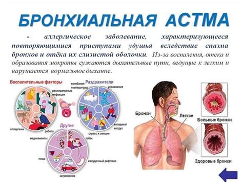 Влияние красной рыбы на функцию мозга и психическое состояние