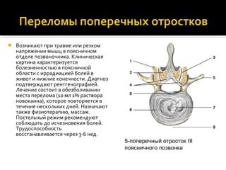 Влияние нарушений структуры позвоночника на нижние конечности