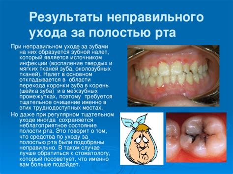 Влияние неправильного ухода за полостью рта на возникновение темных отметин