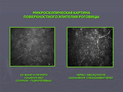 Влияние окружающей среды и погодных условий на состояние глазной поверхности