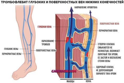 Влияние пемзы на кровообращение в нижних конечностях