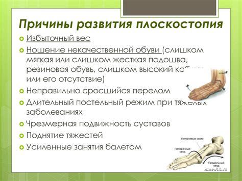 Влияние плоскостопия на занятия гимнастикой: основные аспекты