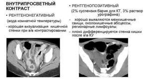 Влияние применения медикаментов на результаты компьютерной томографии малого таза