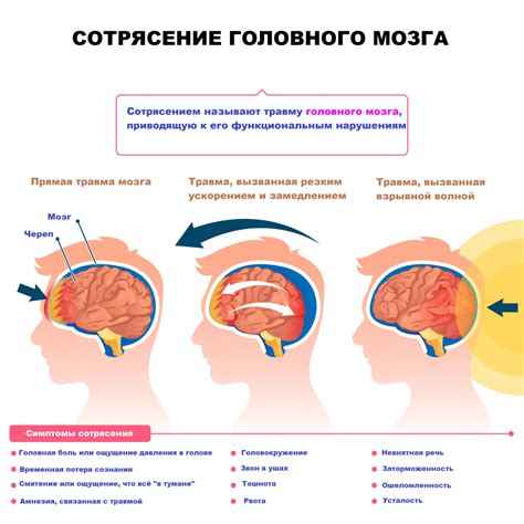 Влияние сотрясения головного мозга на восприятие цвета