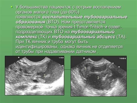 Воздействие нощного освещения на функционирование репродуктивной системы у женщин