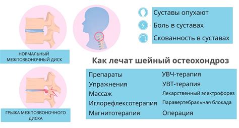 Возможности лечения шейного остеохондроза