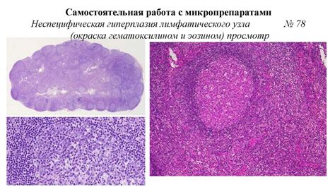 Возможности применения эритроцитарной кроветворной ткани