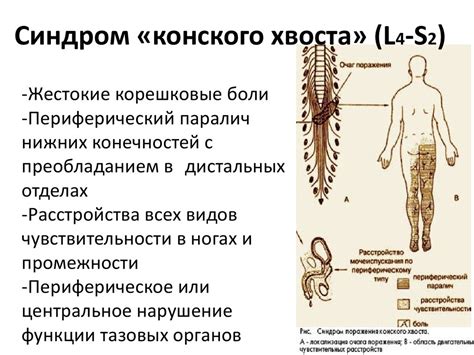 Возможные негативные последствия повреждения спинного мозга