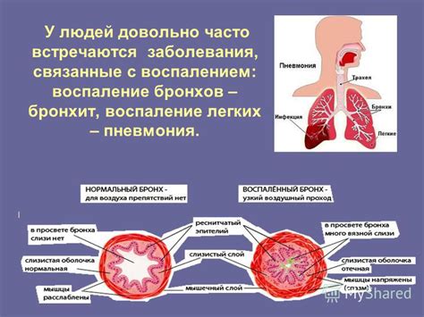 Возможные отклонения и заболевания дыхательной системы у женщин