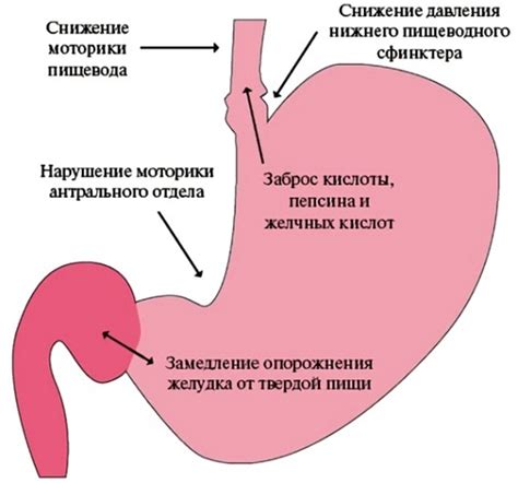 Возможные причины у новорожденных, вызывающие рефлюкс
