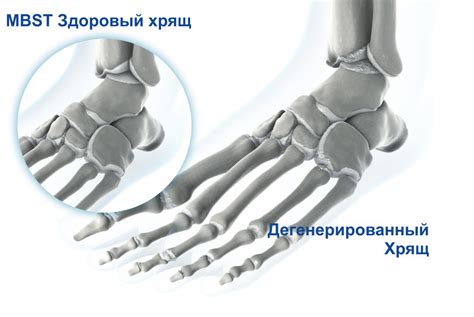 Возможные проблемы и заболевания стопы и голени