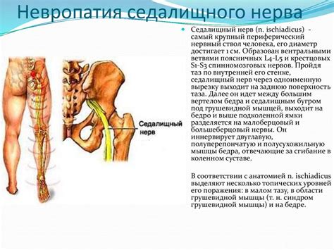 Возможные проблемы при прищемлении седалищного нерва и их влияние на общее здоровье