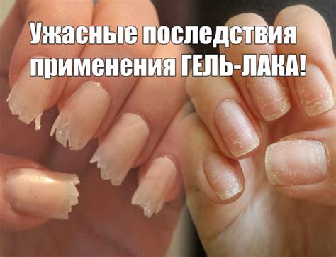 Вредные компоненты гель-лака и их потенциальные последствия
