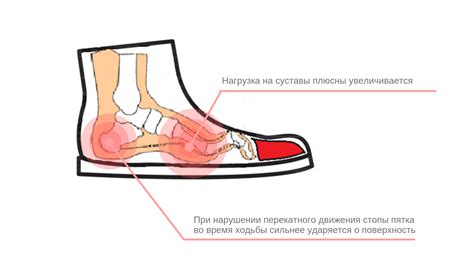 Вред обуви, не подходящей к стопе