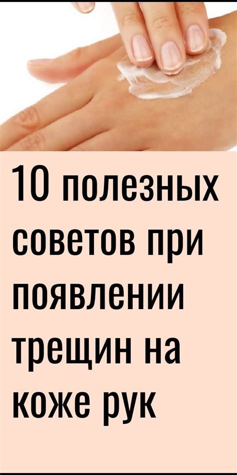 Выбор подходящего продукта для лечения трещин на коже рук