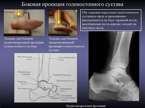 Гибкость и подвижность важная черта голеностопного сочленения