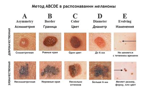 Главные симптомы новообразования с кровотоком