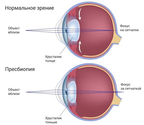 Действие буфера на глазные заболевания