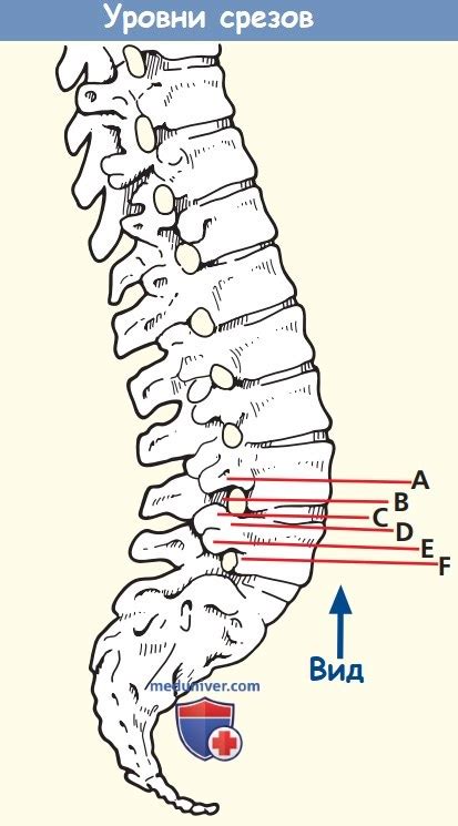 Детальная анатомия и точное определение положения пятого и шестого поясничных позвонков