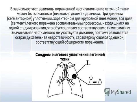 Детектирование и изучение изменений в легочной ткани: диагностические методы и процедуры