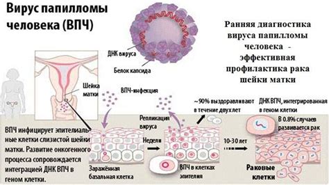 Диагностика вируса ВПЧ