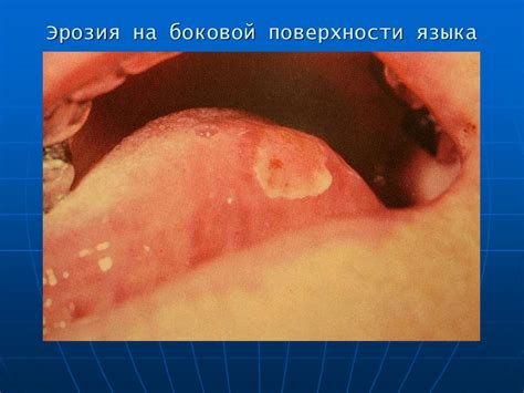 Диагностика и классификация внемедицинских пятен на поверхности языка